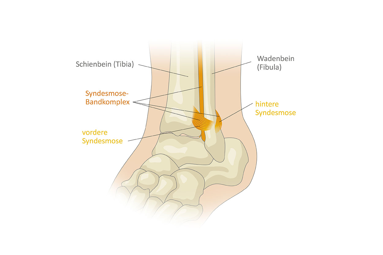 Anatomiegrafik Sprunggelenk, Syndesmose-Bandkomplex, Website